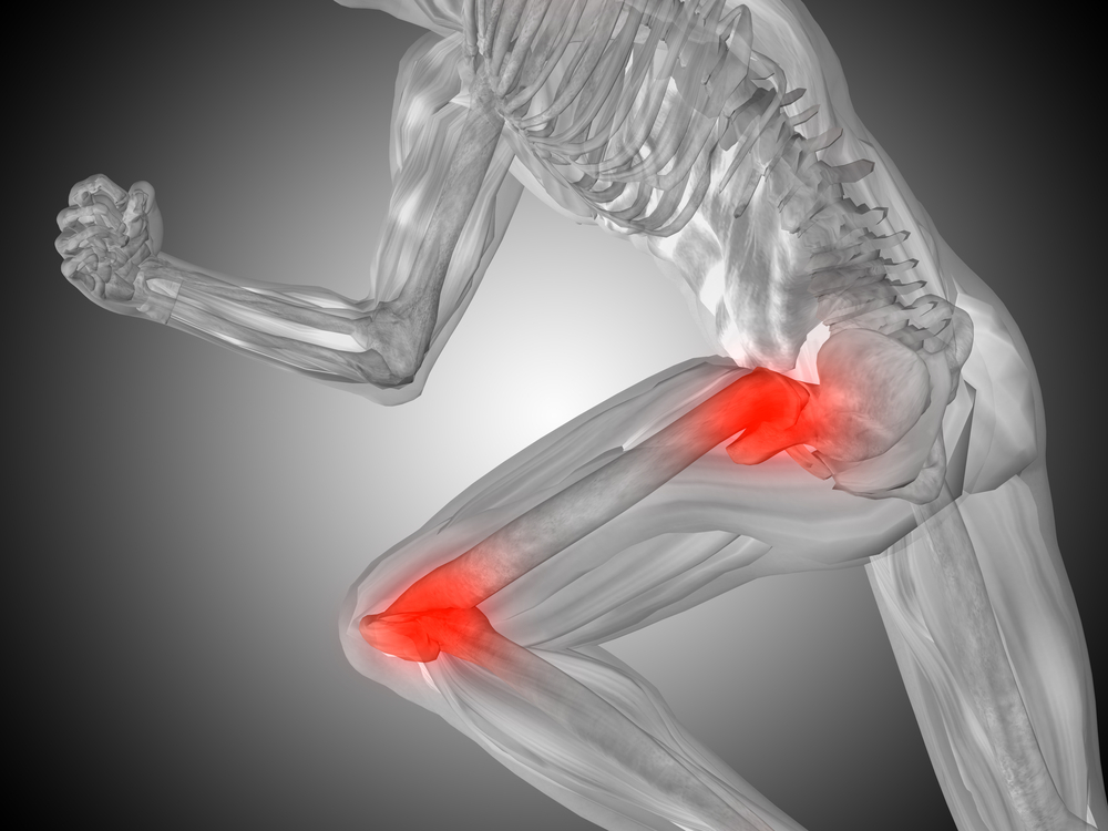 Hip & Knee Pain Leitchfield, KY